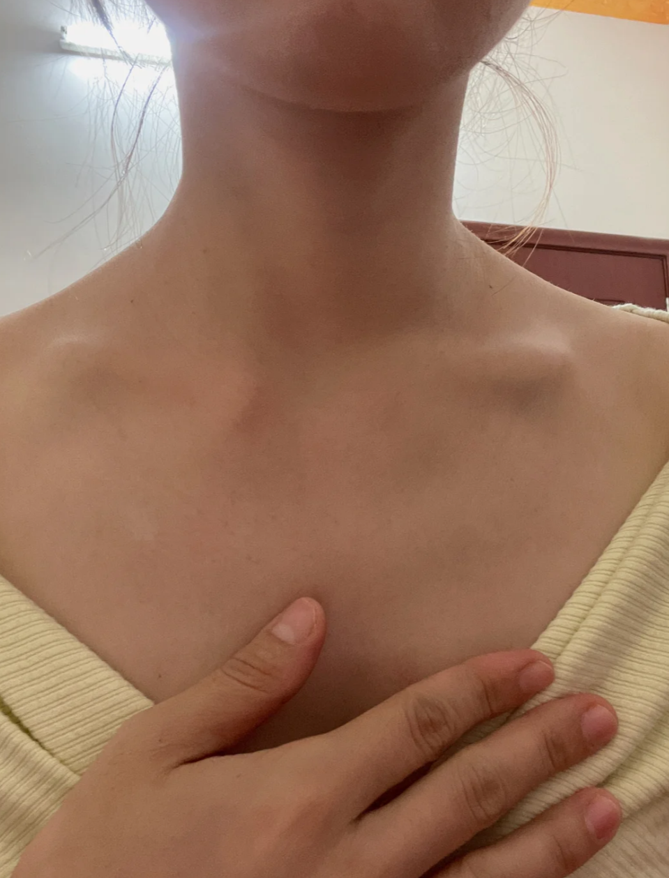 胸骨下面有个骨头凸起的原因