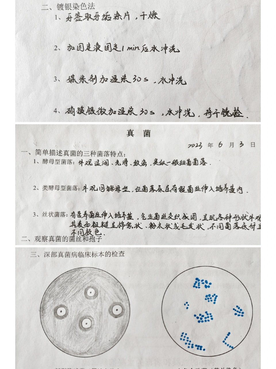 病原生物学与免疫学实验-绘图Ⅴ 钩端螺旋体 回归热螺旋体 梅毒螺旋体