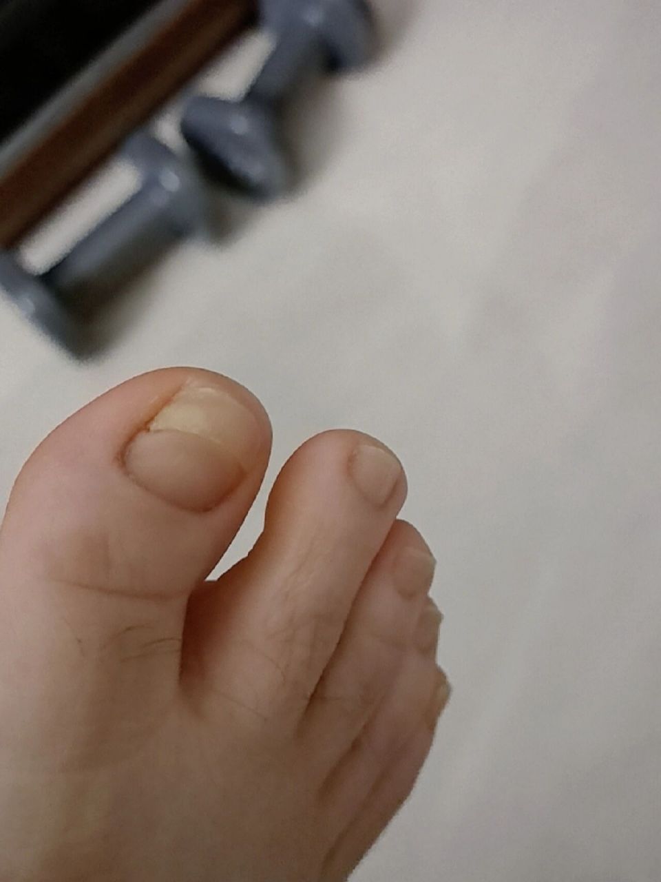 大脚趾突然疼痛 前晚开始大脚趾突然半夜痛,指甲左边部分,一按指甲就