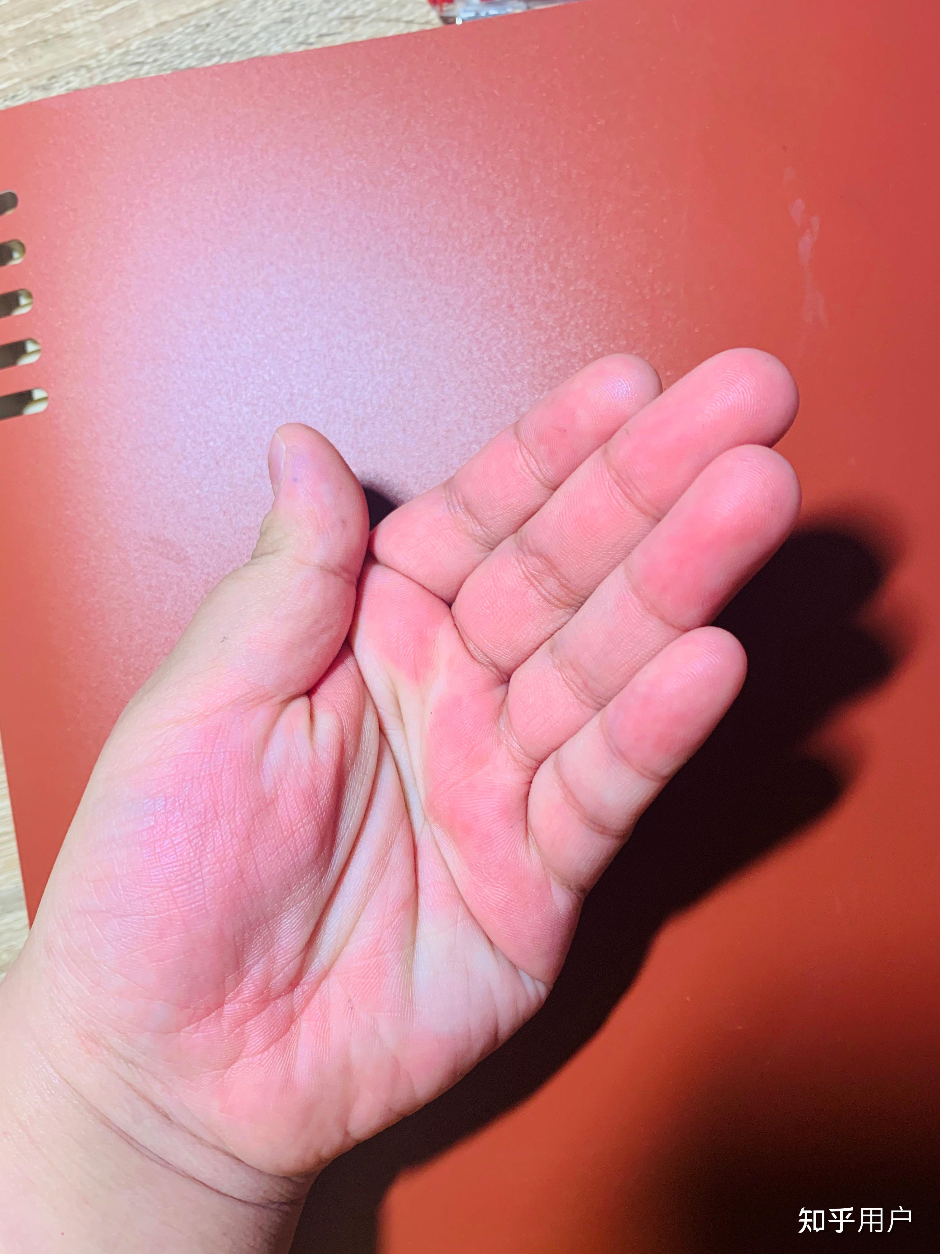 有人被老师打过手心吗具体说下过程谢谢