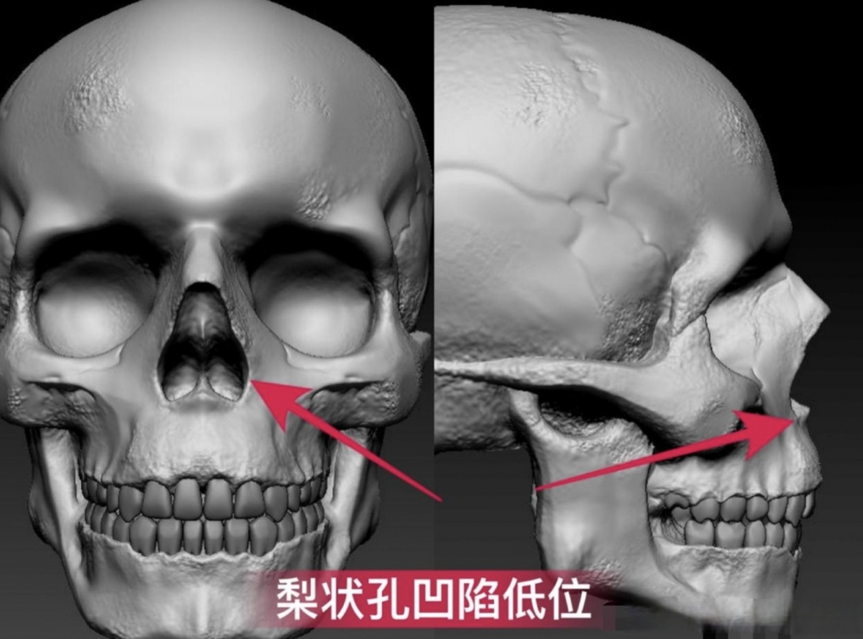 梨状孔位置图片