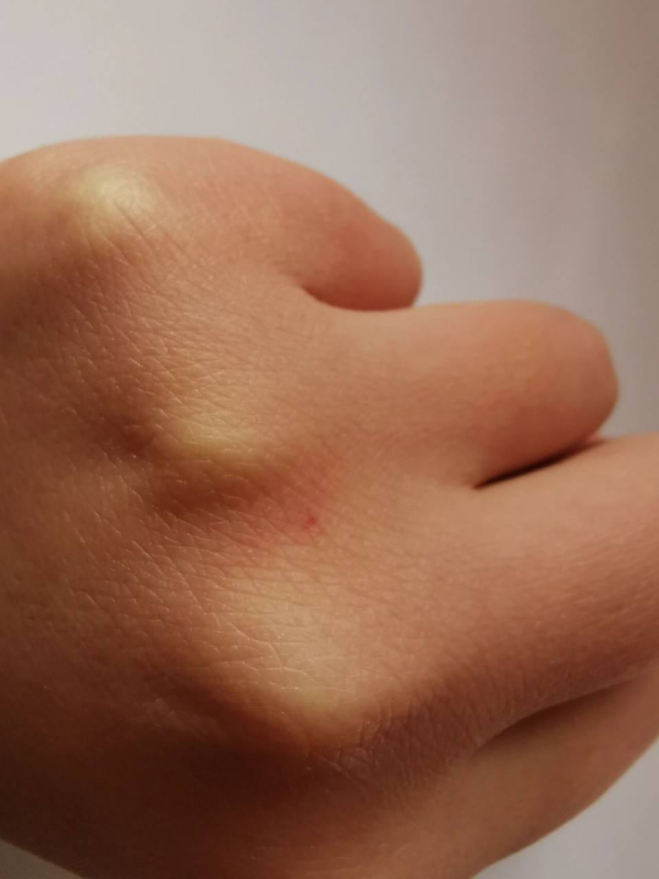 一个多月大的狗狗抓伤是不是要死了?