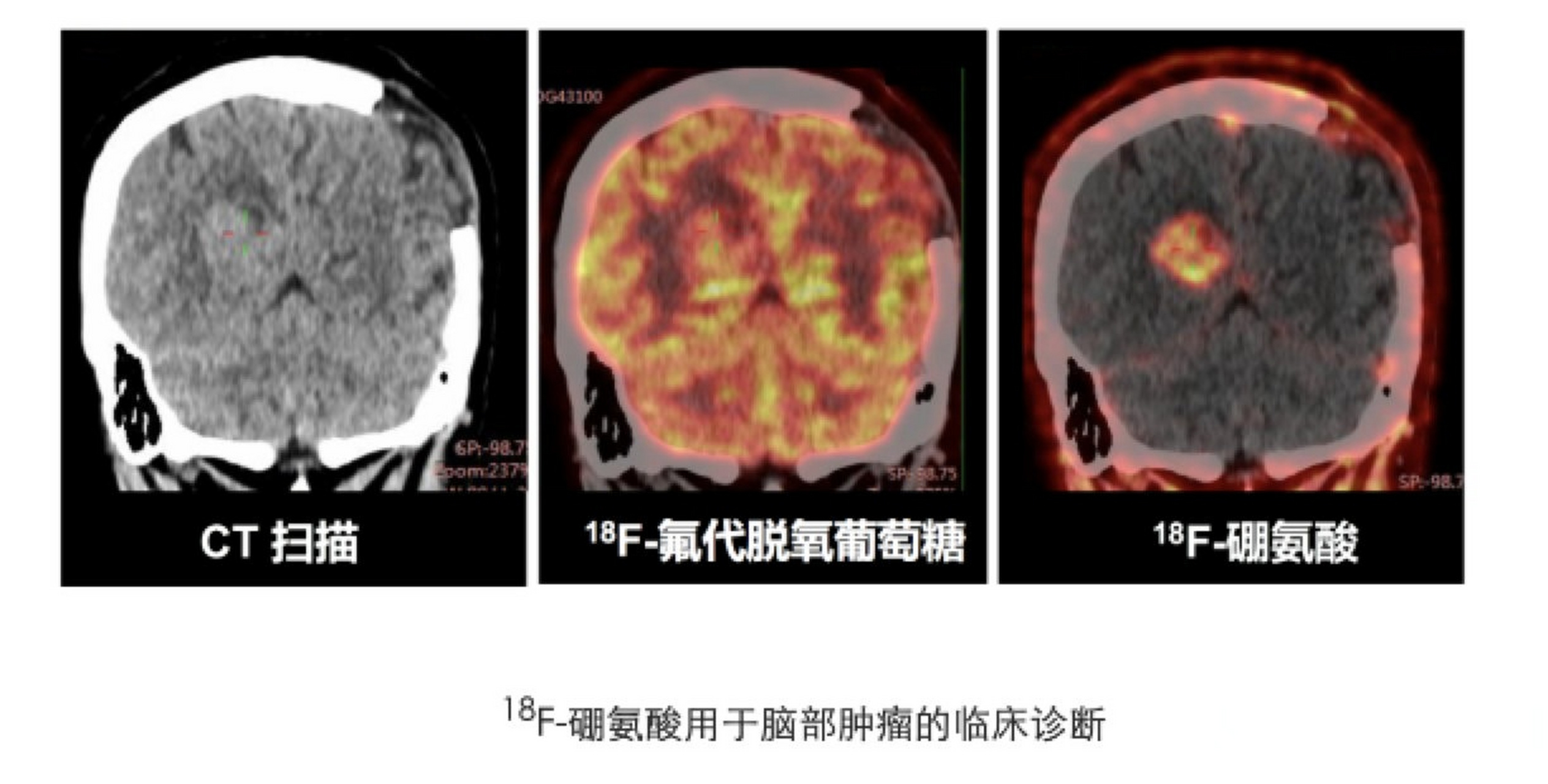 北大化学学院刘志博课题组与合作者报道新型核药物的临床转化研究】