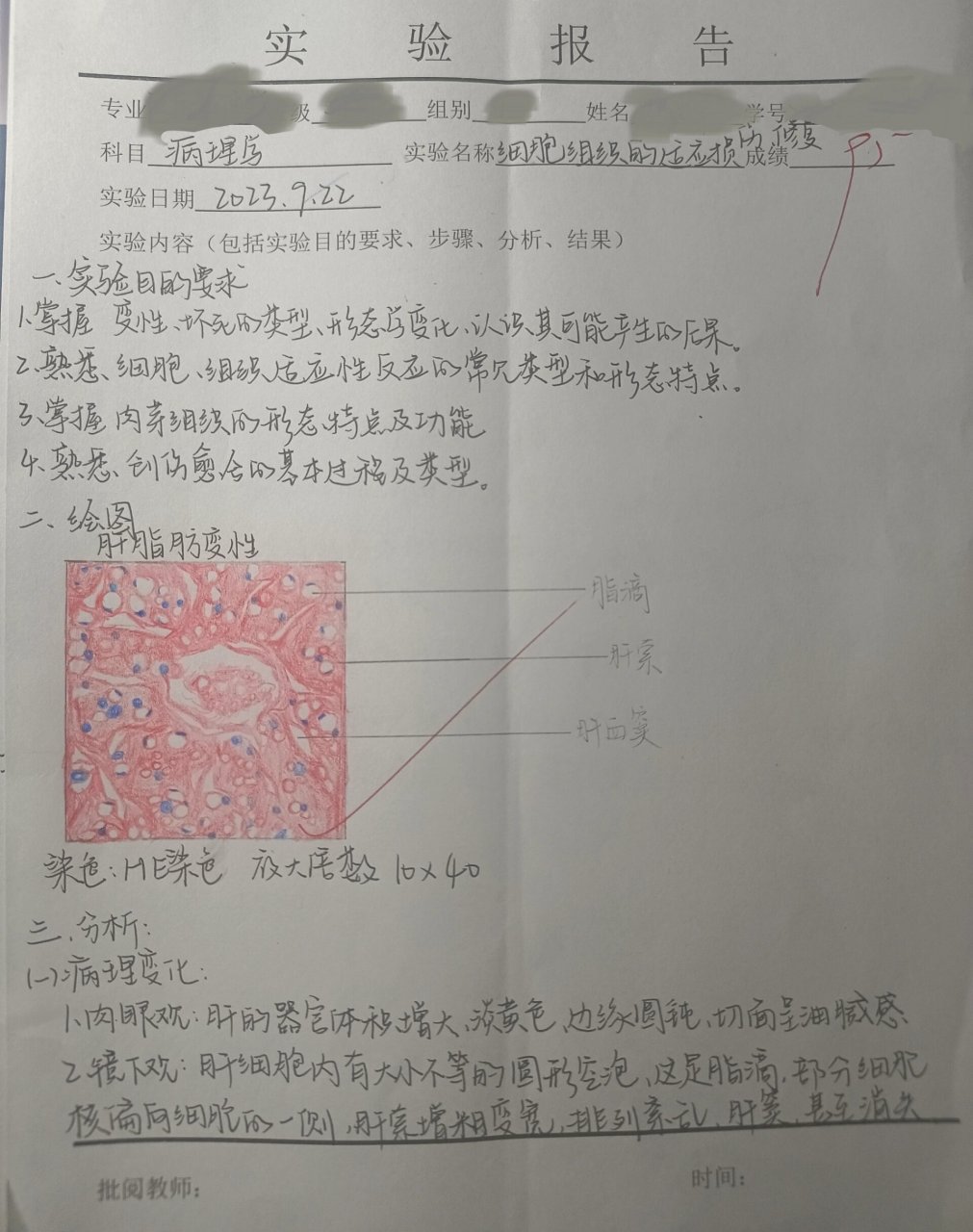 get病理学实验——红蓝铅笔绘图 肝脂肪变