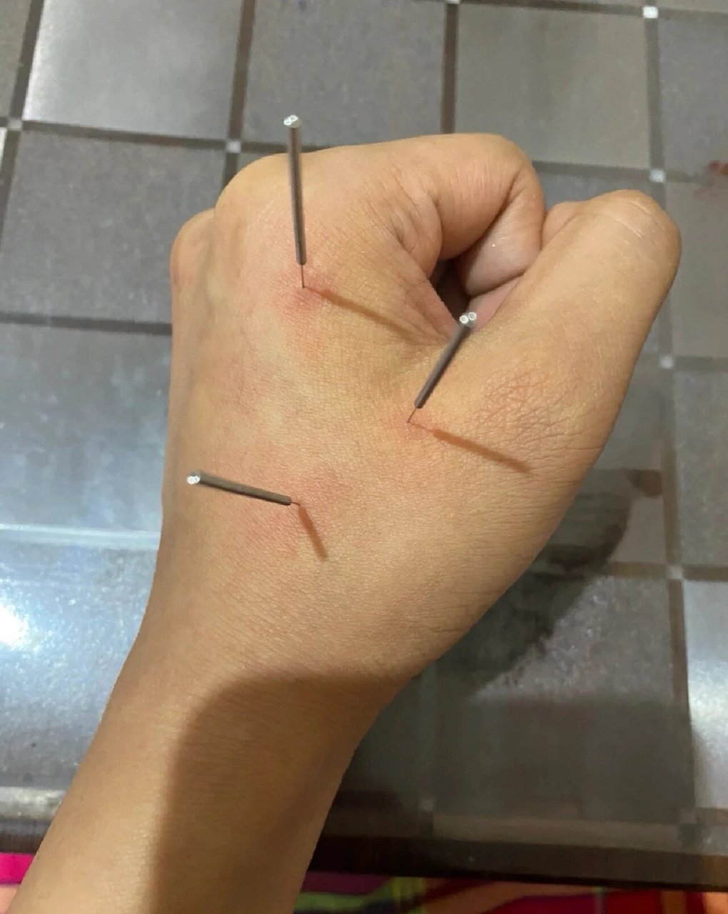 董氏奇穴,气血三针