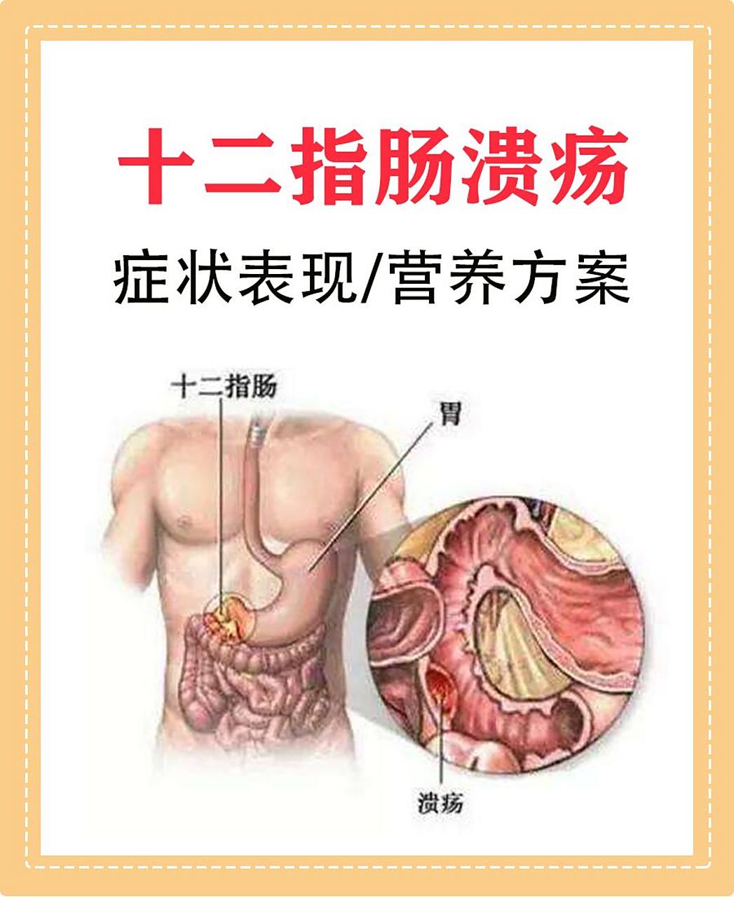 十二指肠疼痛症状图片