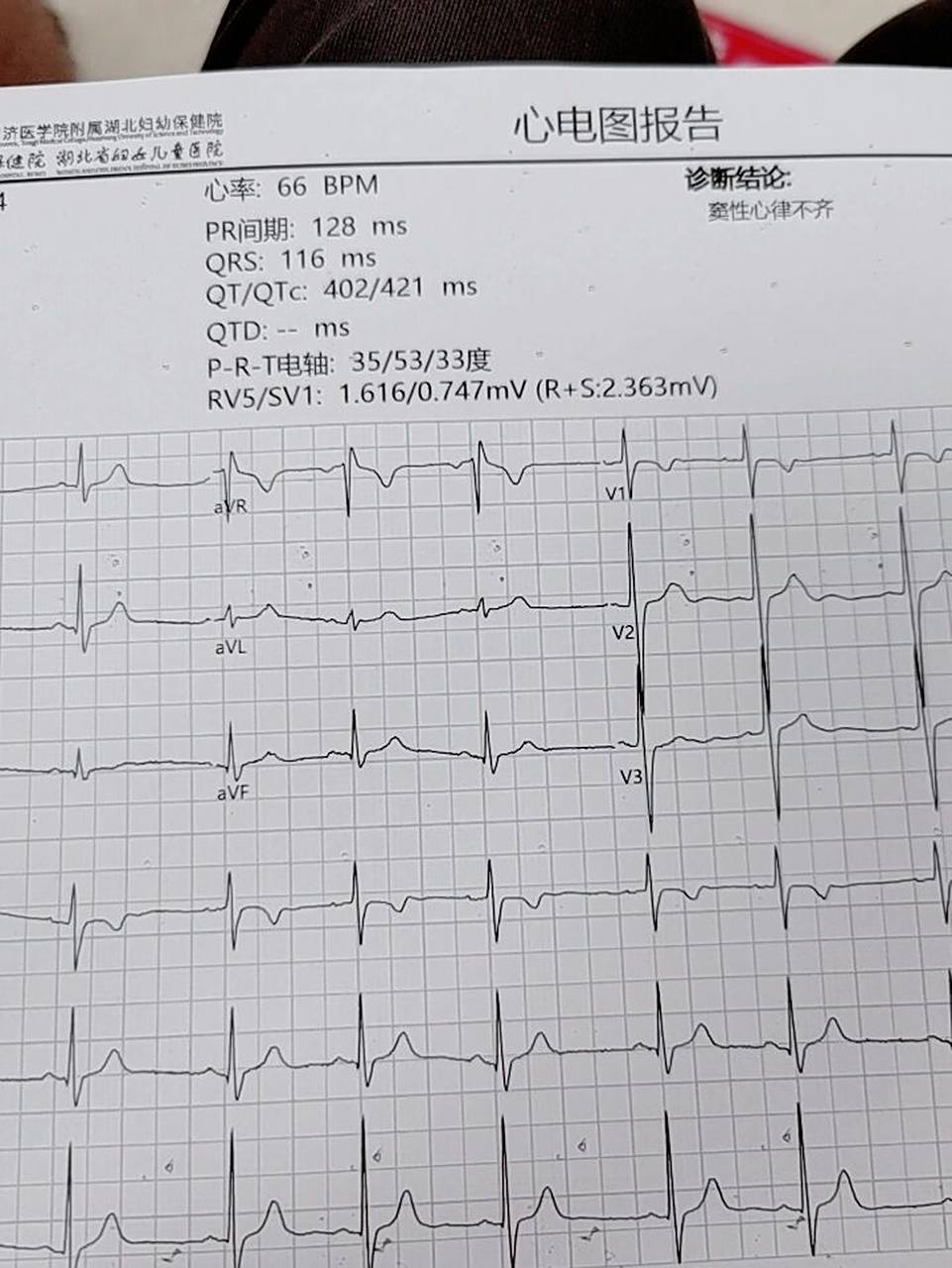 原来做心电图只要5秒 省妇幼心电图真是惊呆我了.