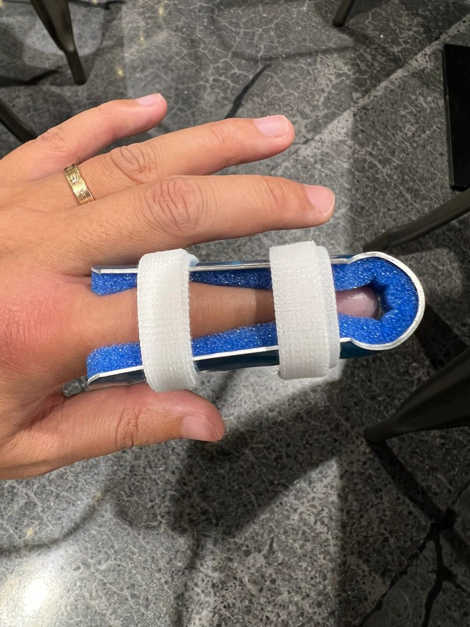 手指脱臼😣😖 昨天打篮球,一次很普通的防守,我伸手去断球,速度太