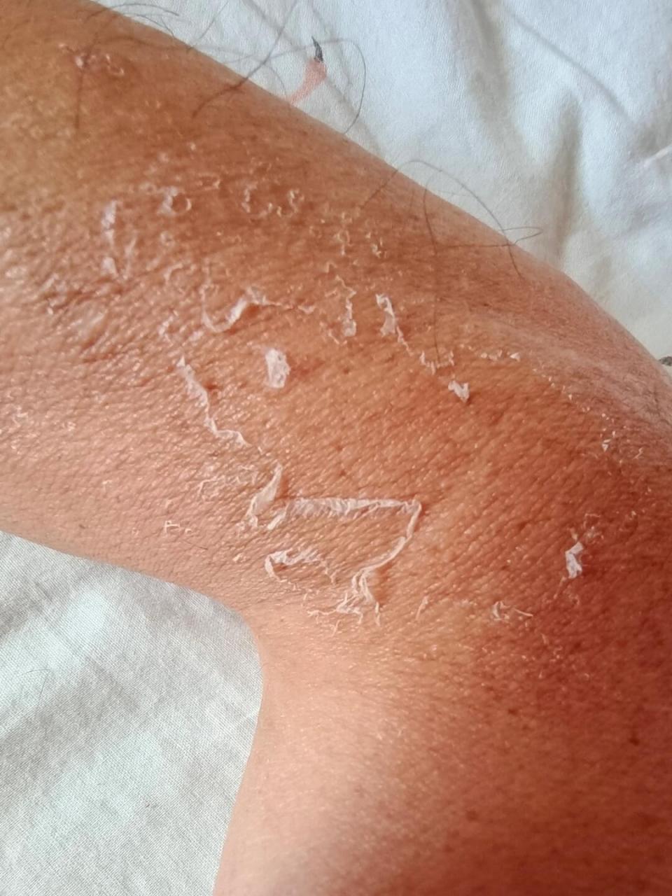 谁要说这不是一只老乡的胳膊呢,现在谁还把自己的胳膊晒爆了皮,看着