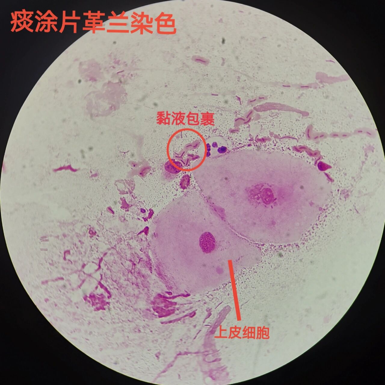 铜绿假单胞菌鞭毛图片