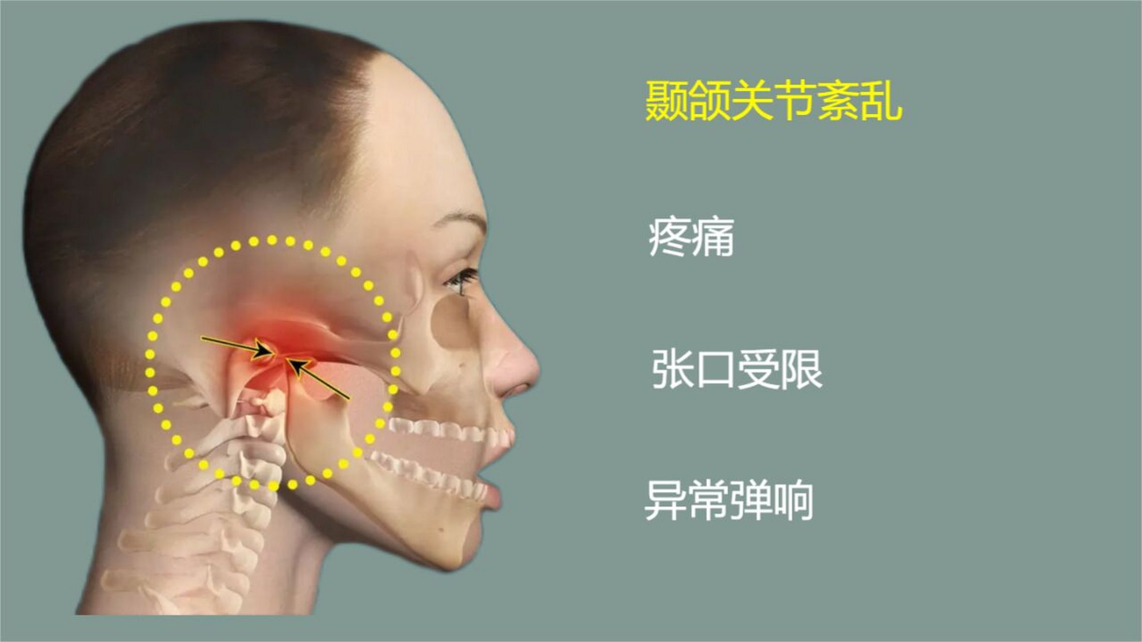 颞颌关节炎只有一侧疼图片