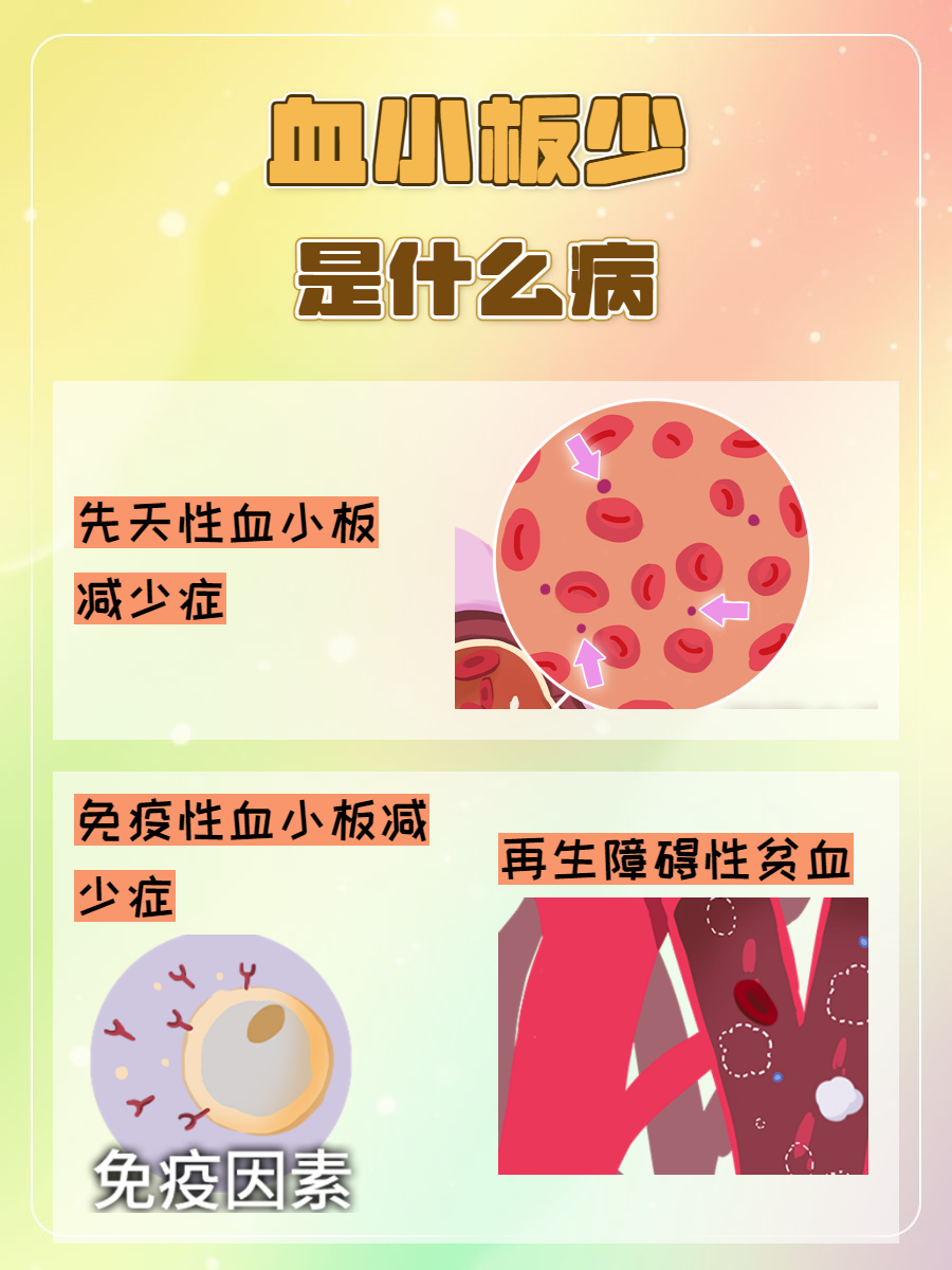 血小板减少