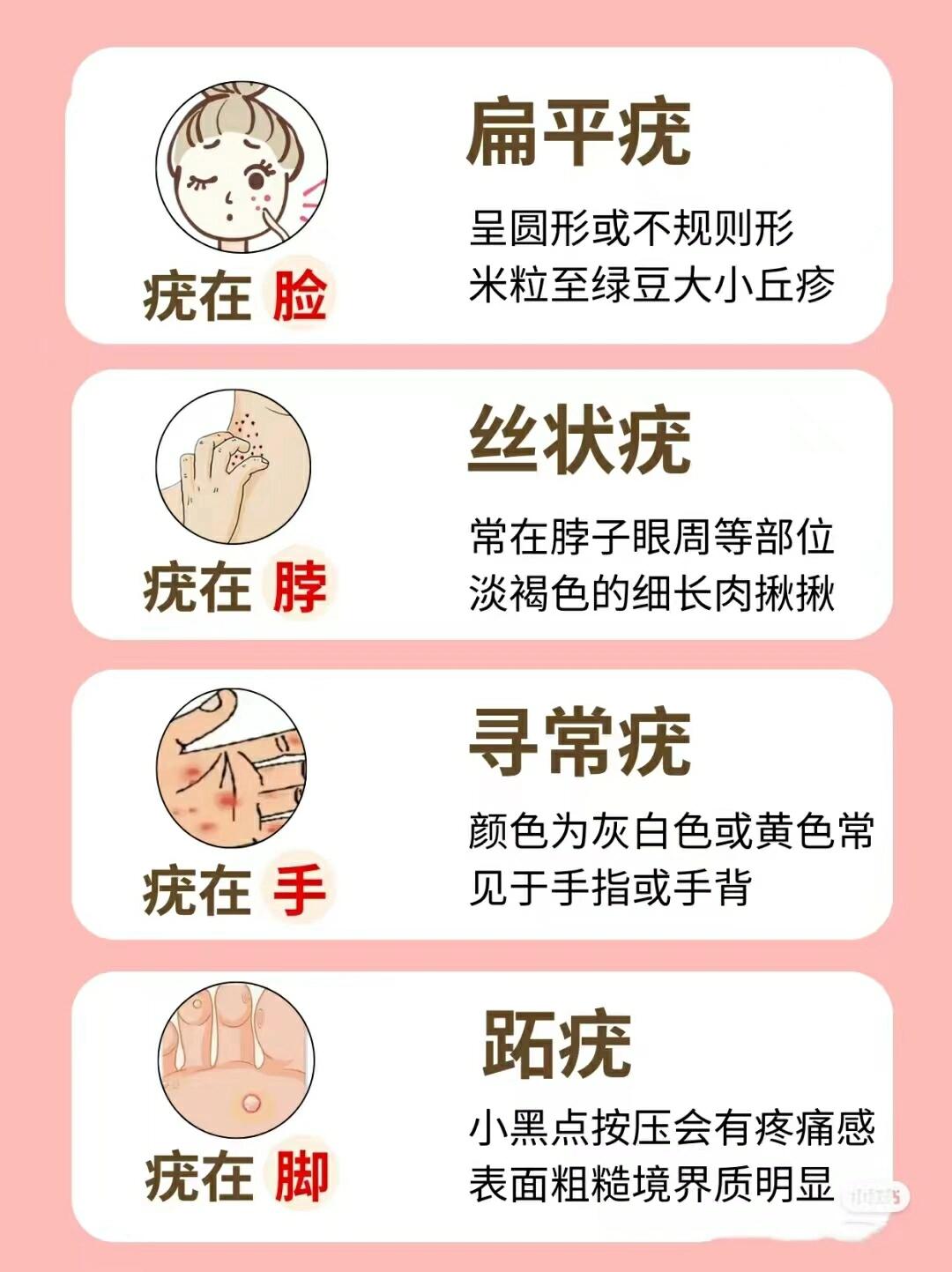 快来看看你的疣在哪里?女生必看!