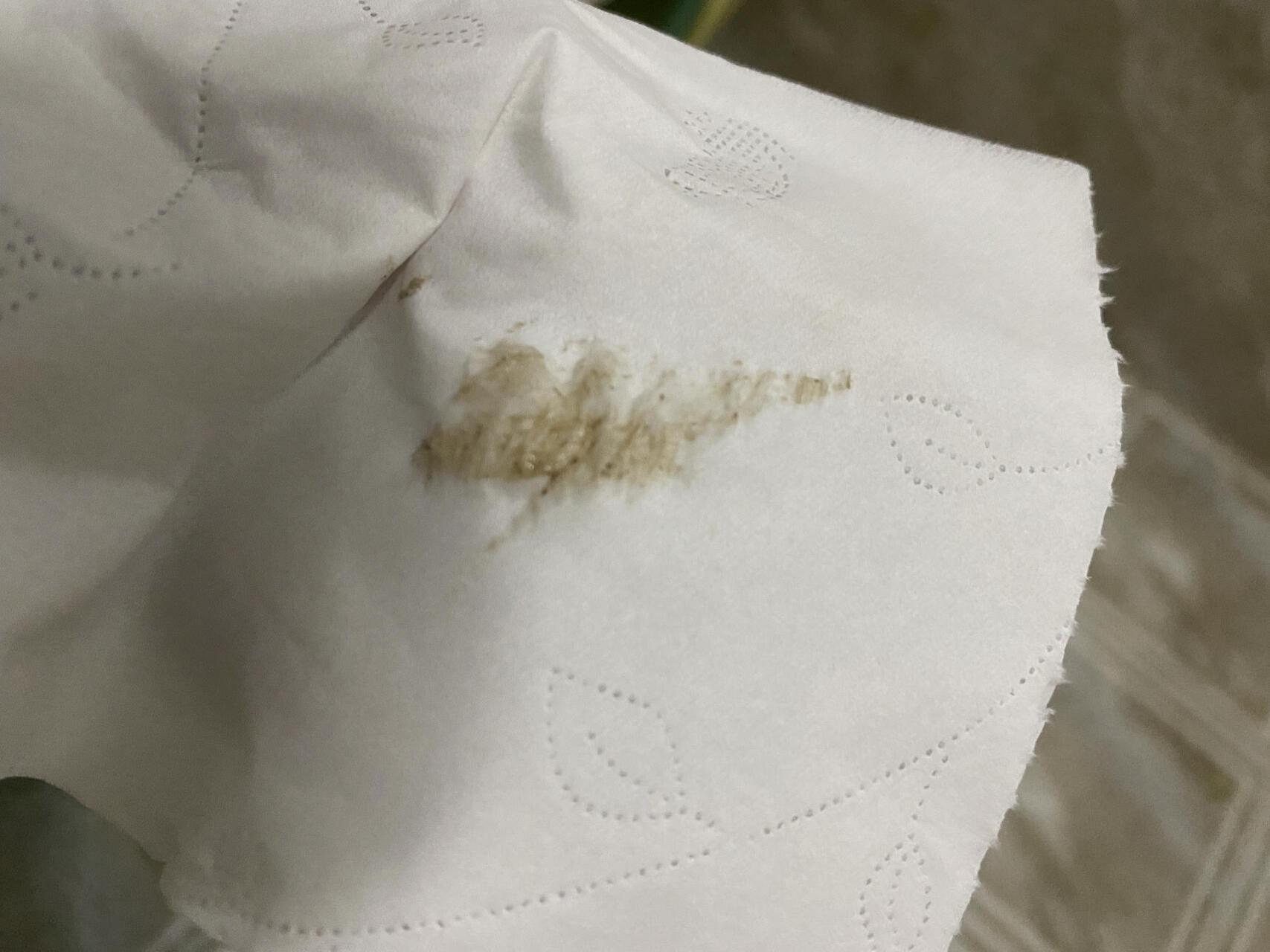 孕42天,褐色分泌物持续10来天了 刚知道自己怀孕,查的血hcg 孕酮都