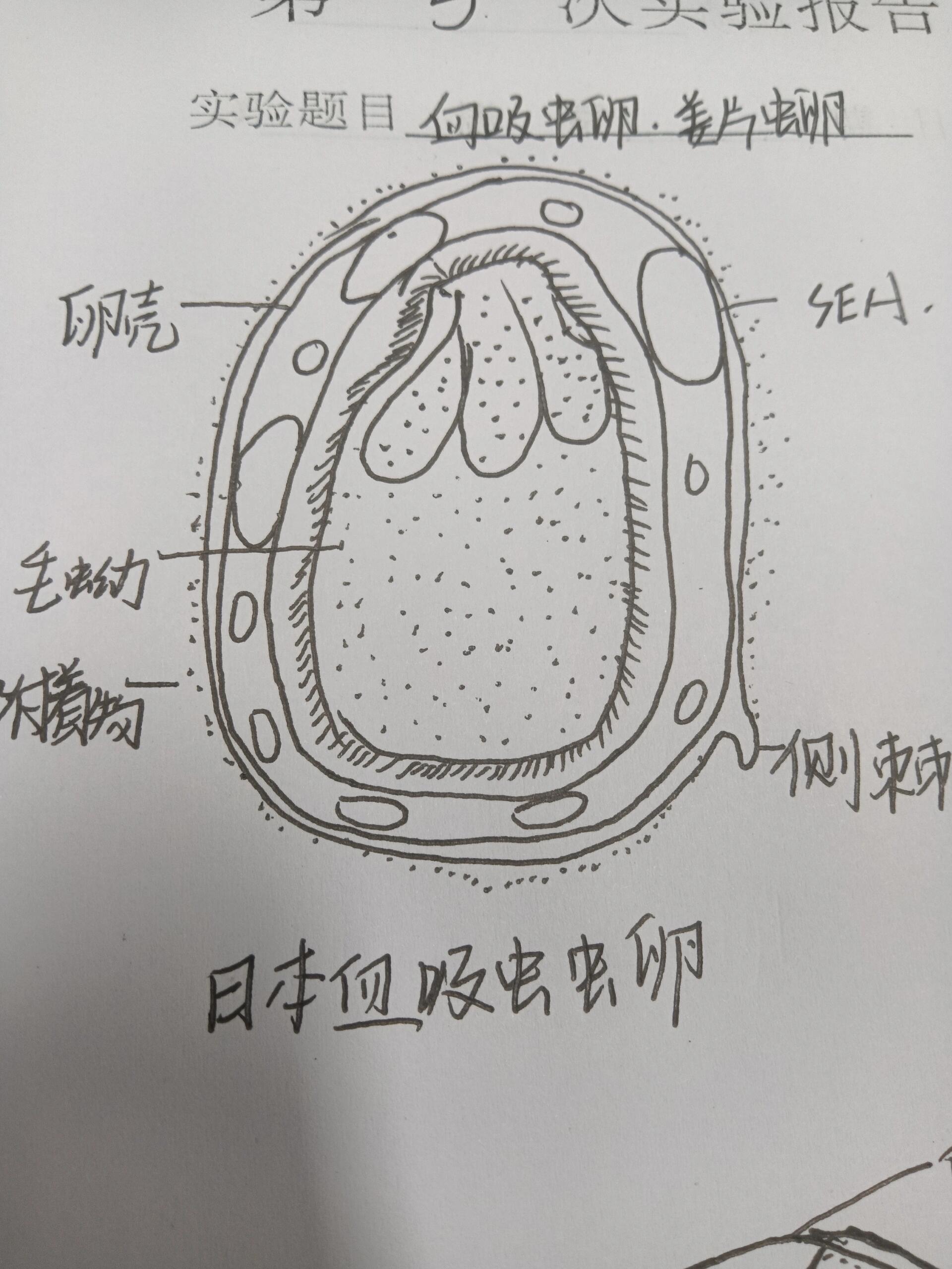 姜片吸虫卵结构图图片