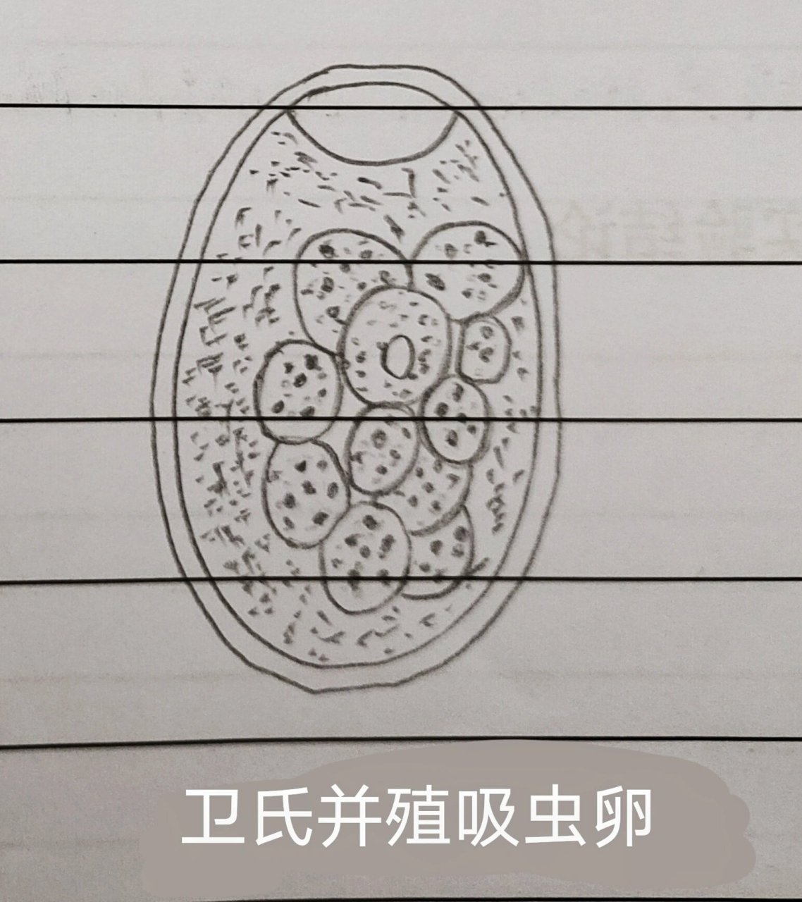 卫氏并殖吸虫卵