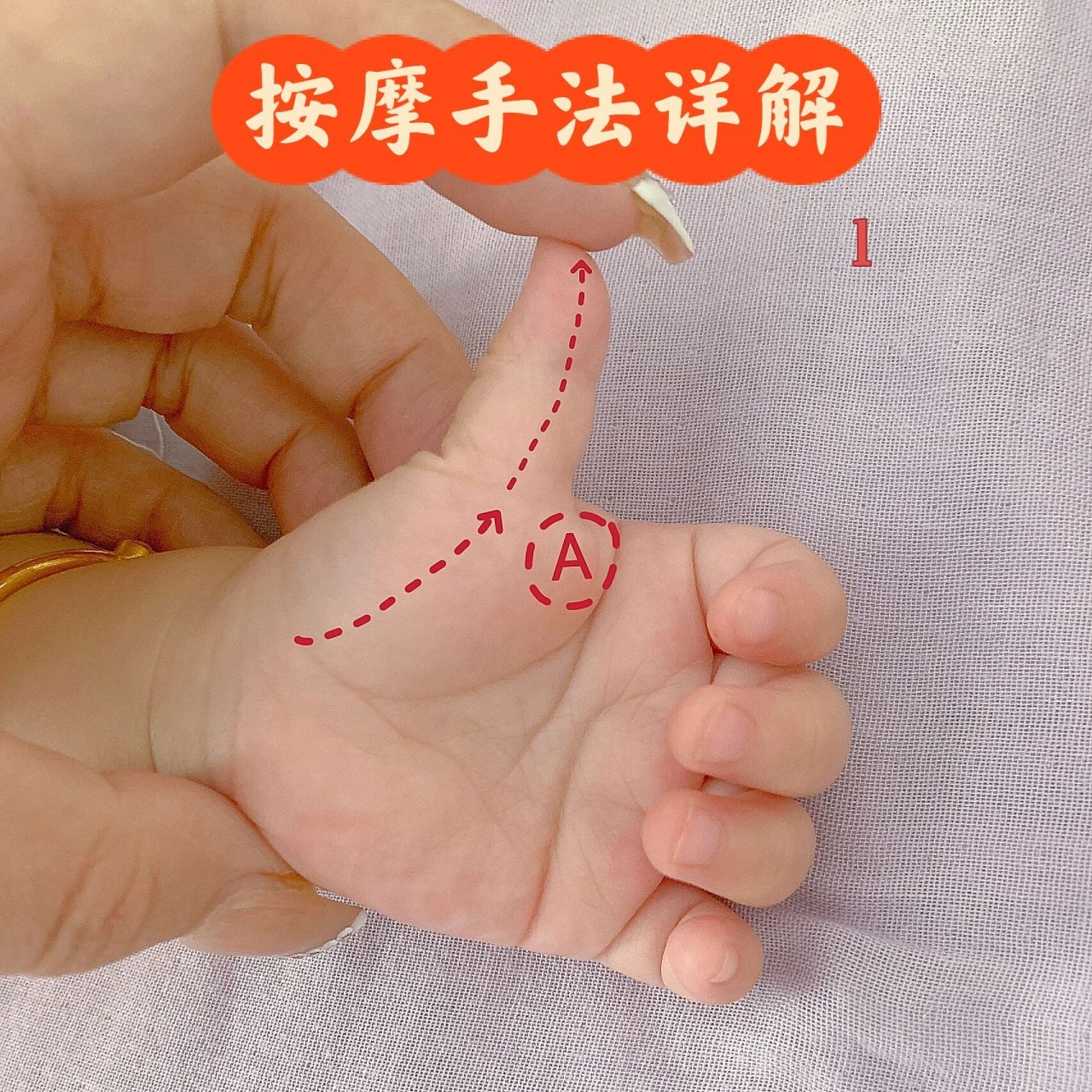 小儿腱鞘炎扳机指大拇指伸不直按摩手法 注意按摩手法是自己日常摸索