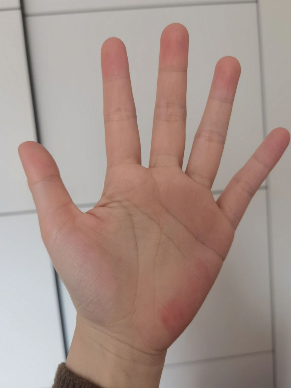 已经一两年了吧,从生完孩子以后就发现了,之前没有肝病史,但是经常