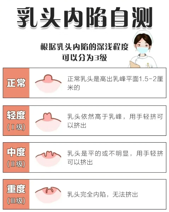 女生乳头小通常和遗传,发育问题或者疾病有关