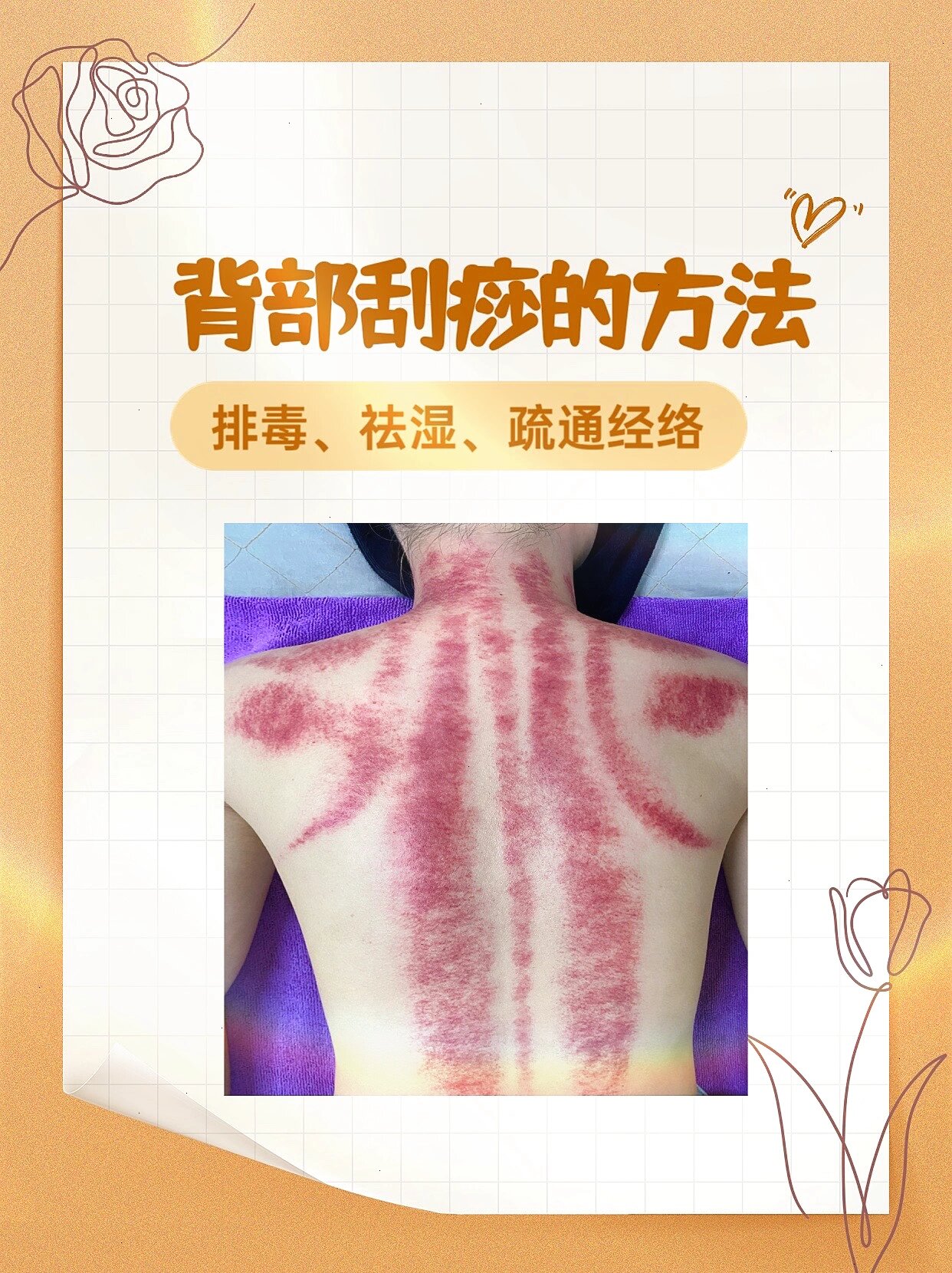 背部刮痧的方法,以及注意事项,禁忌