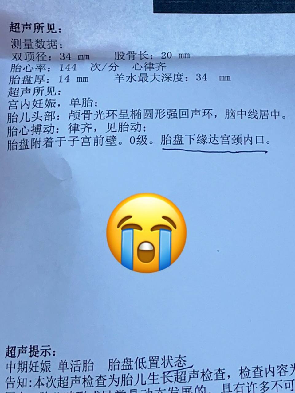 今天16周77 去社区建档做个b超说我胎盘低置状态!