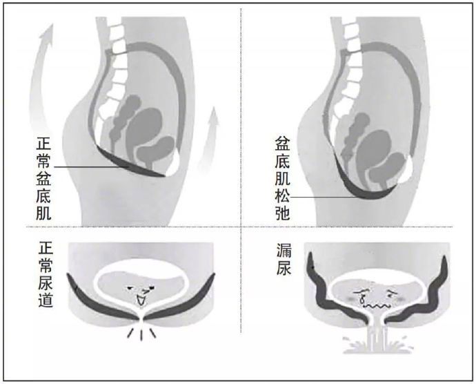 子宫下段形成图片