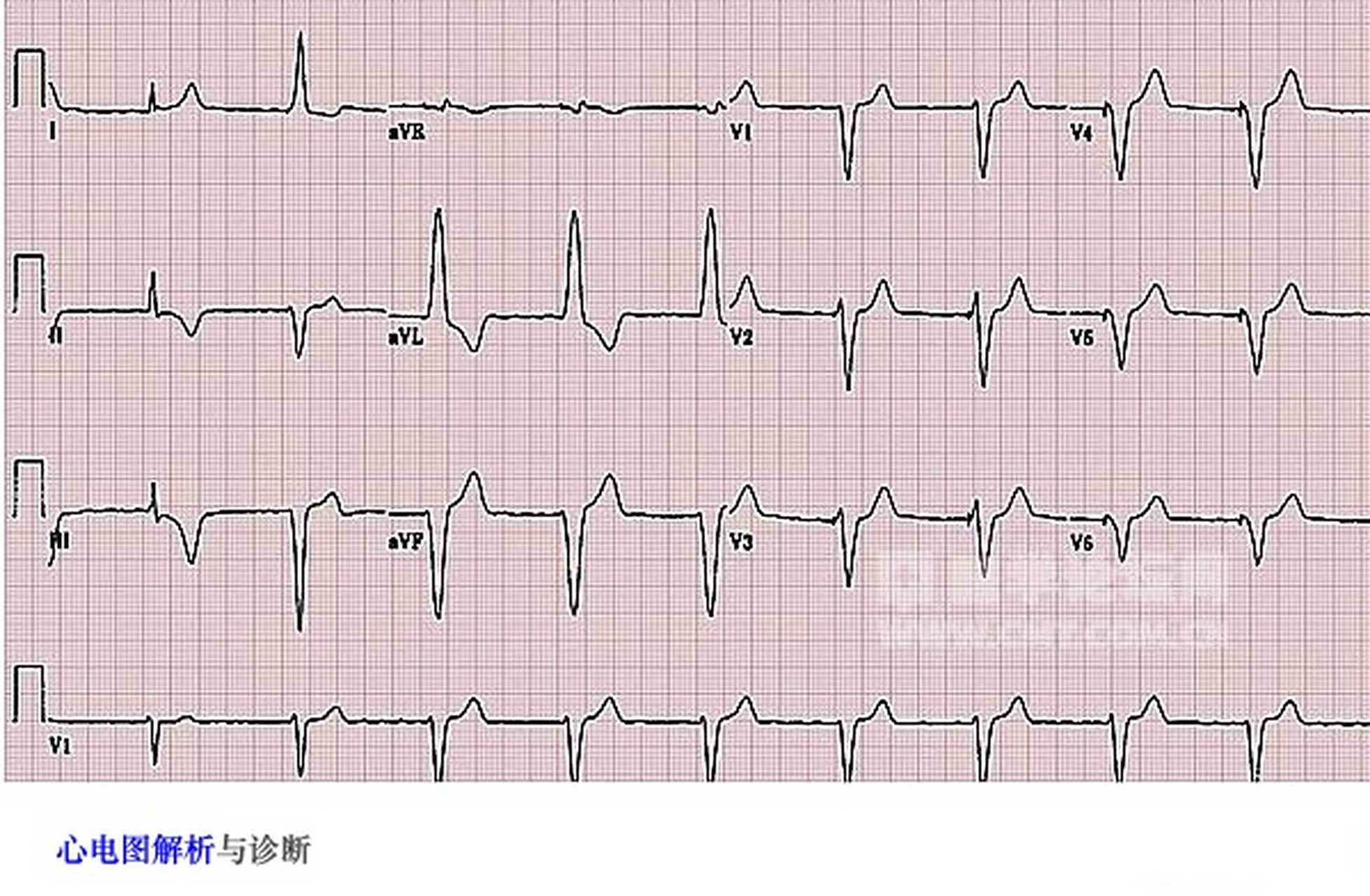 如果你的心率慢或快可能是某些心脏疾病或其他健康问题的症状.