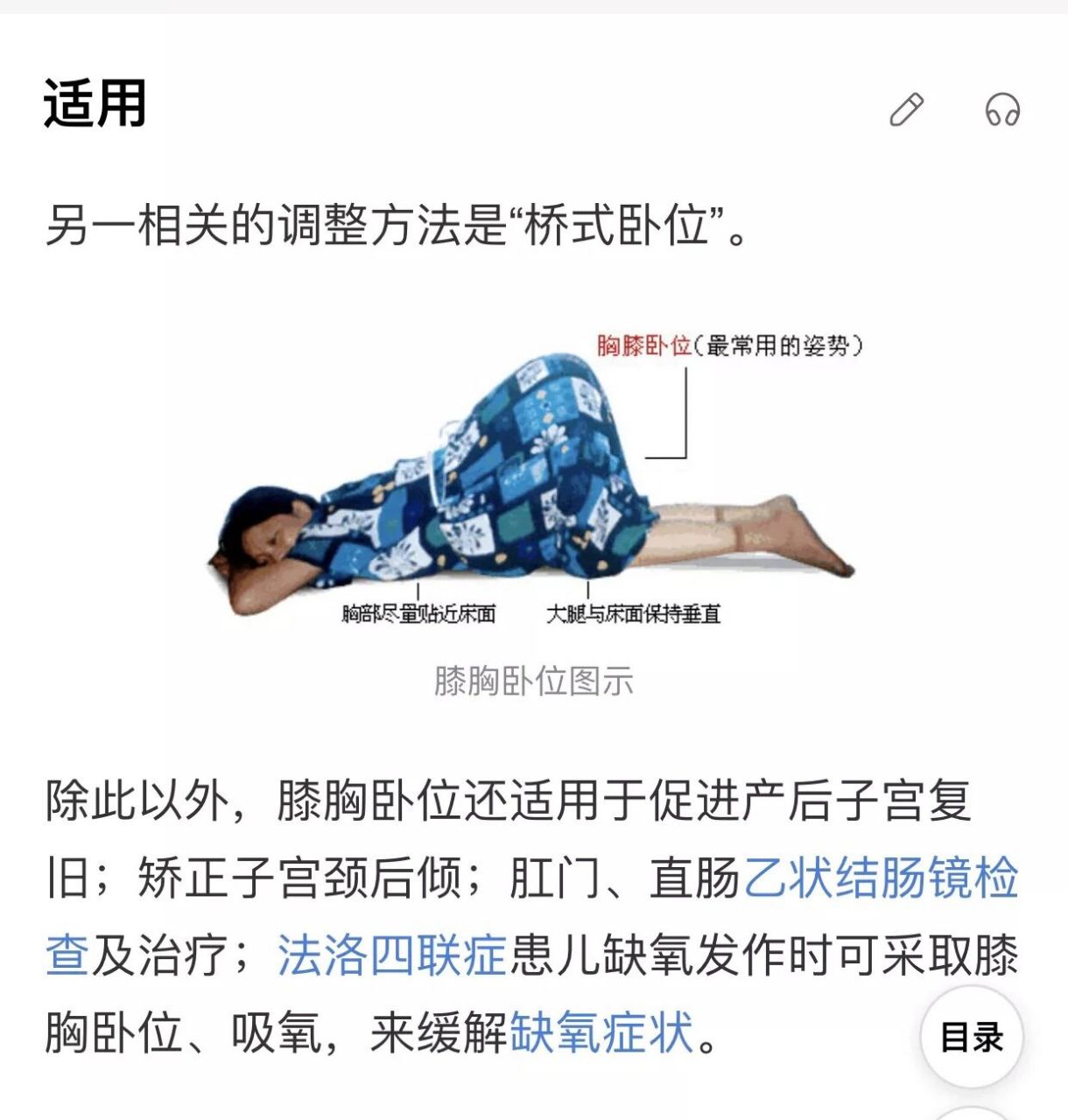 子宫后位怎么办?