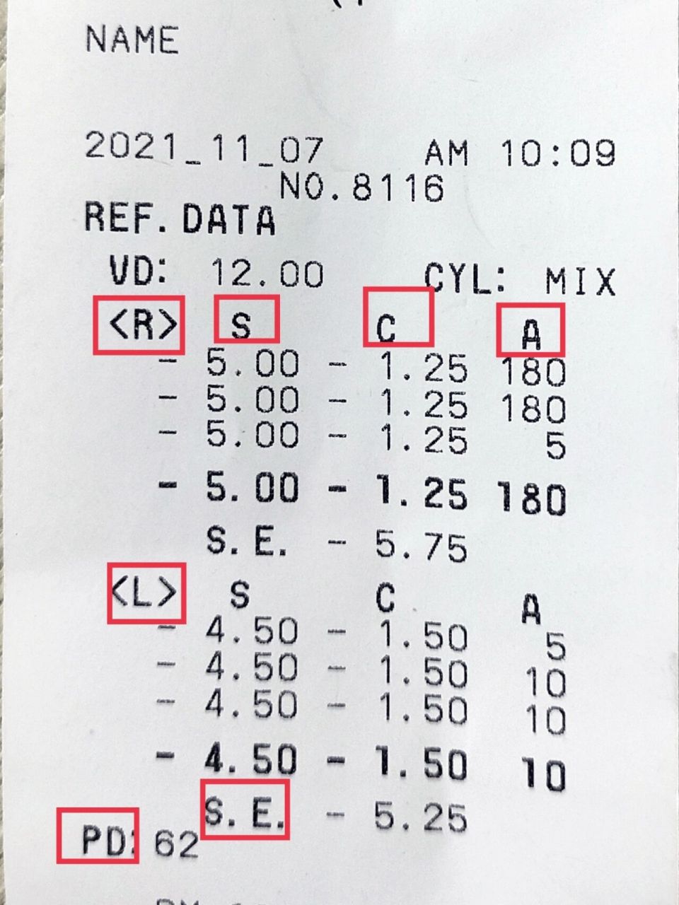 一招教你怎么看近视手术的电脑验光单 r——右眼 l——左眼 s——近视