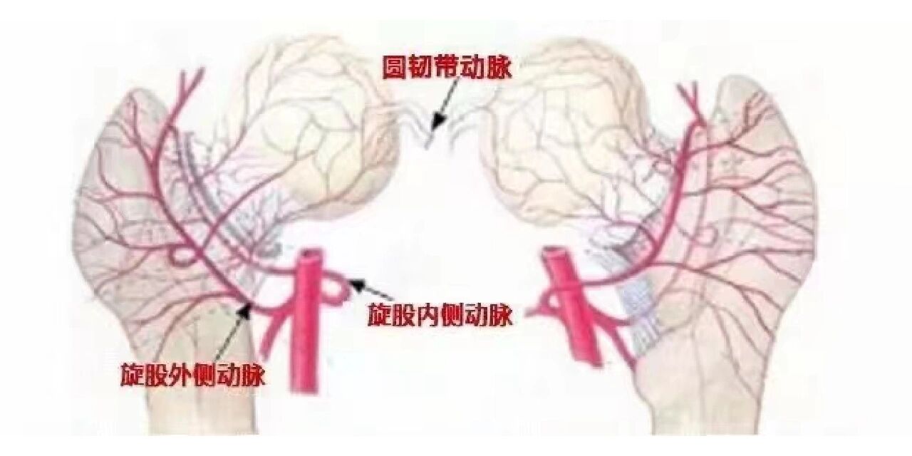 然后随着血液循环,这些杂质不断沉积最终"堵住"了股骨头的供血血管