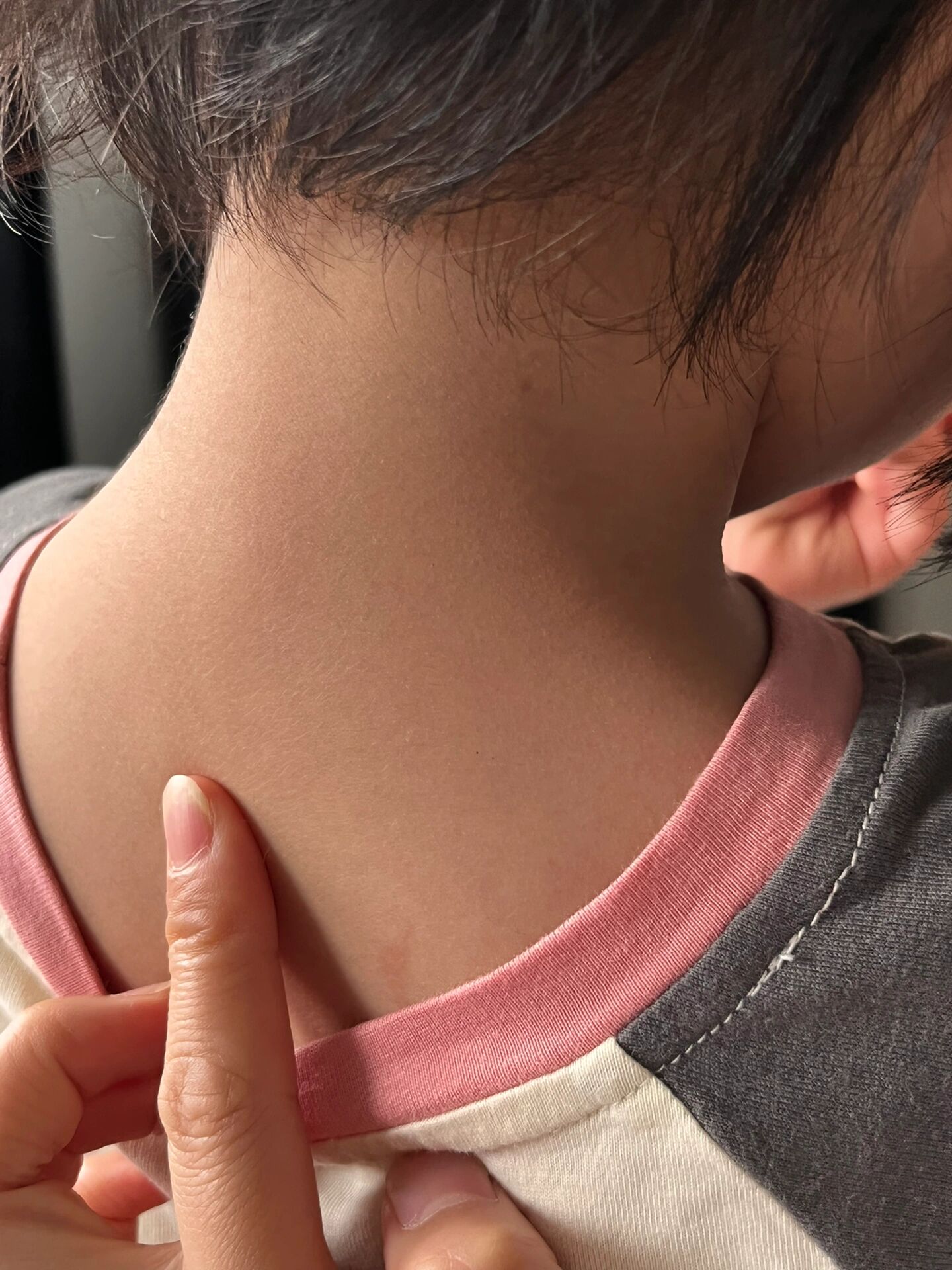 孩子脖子前倾 去年开始发现孩子脖子手指按的位置骨头比别的小朋友要