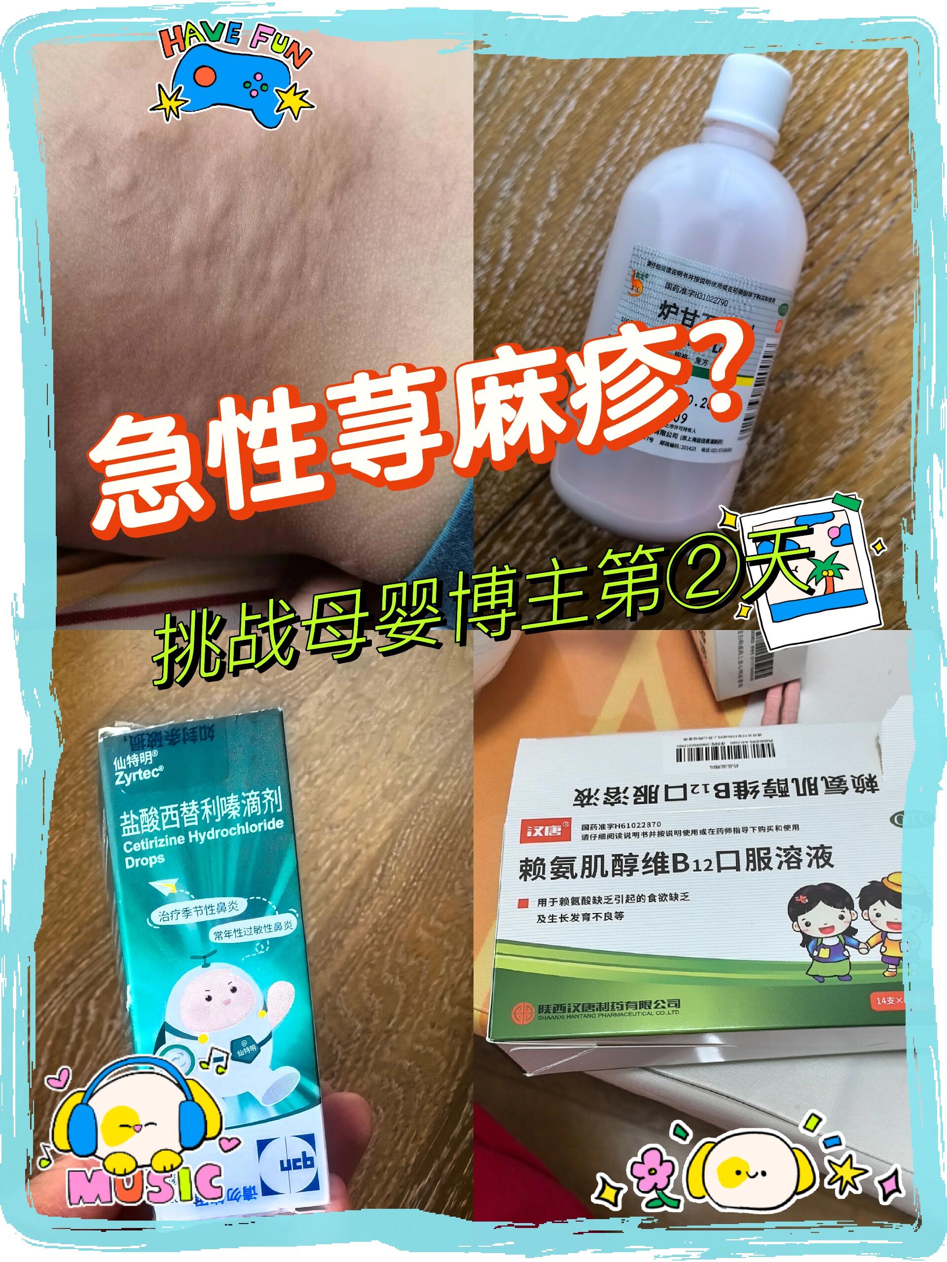 挑战母婴博主第②天,急性荨麻疹的应对 自从宝宝生病住院出院后,由于