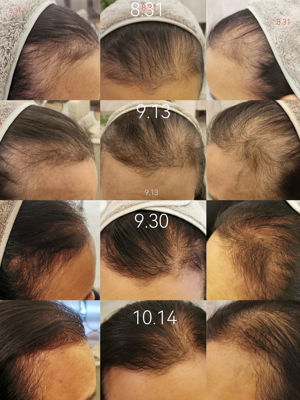 都来围观看看要长新生发的毛囊是啥样 放大图二图三, ​你会看到不