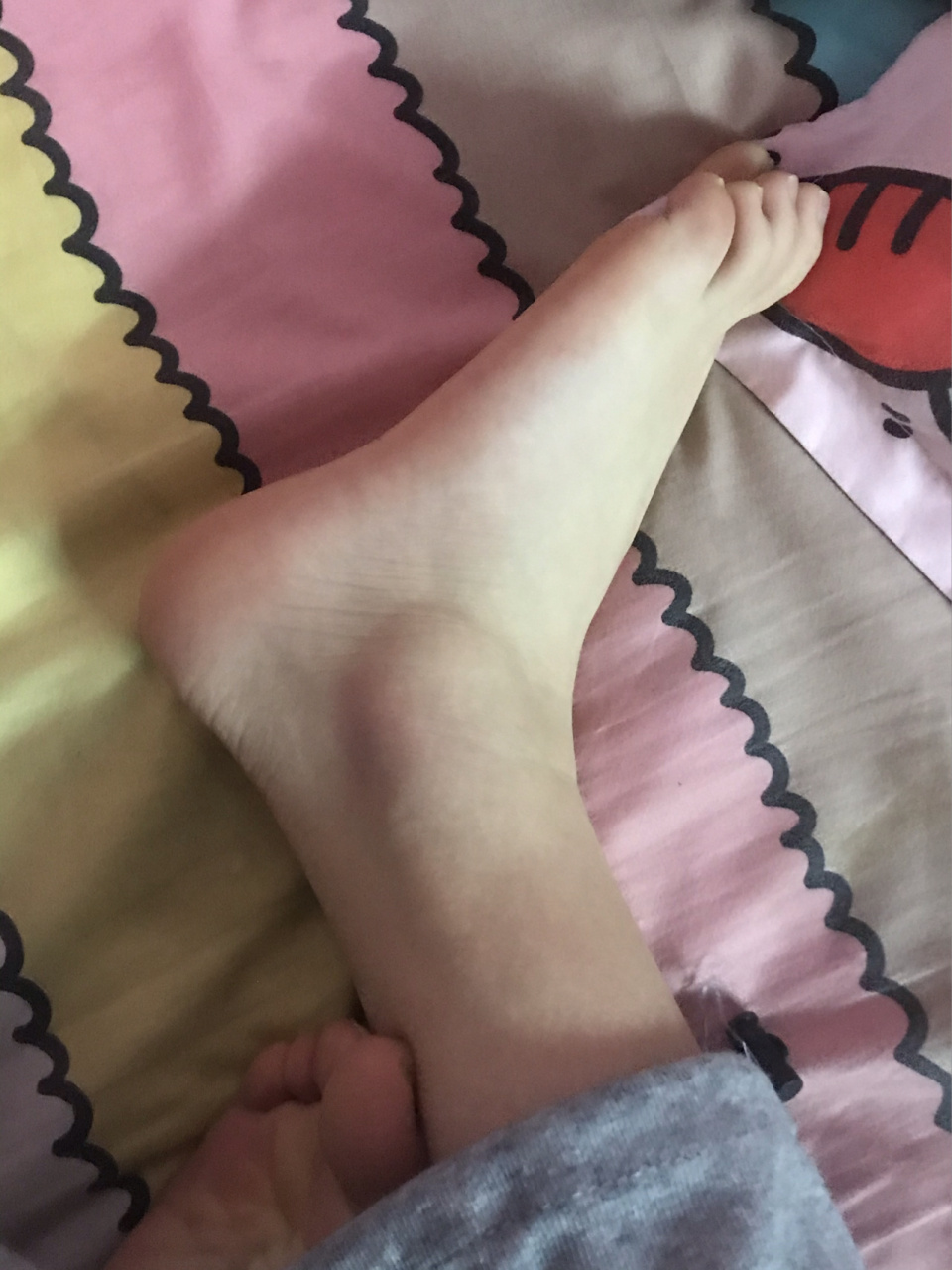 脚崴了需不需要拍片啊 今天走楼梯不小心摔了 脚踝