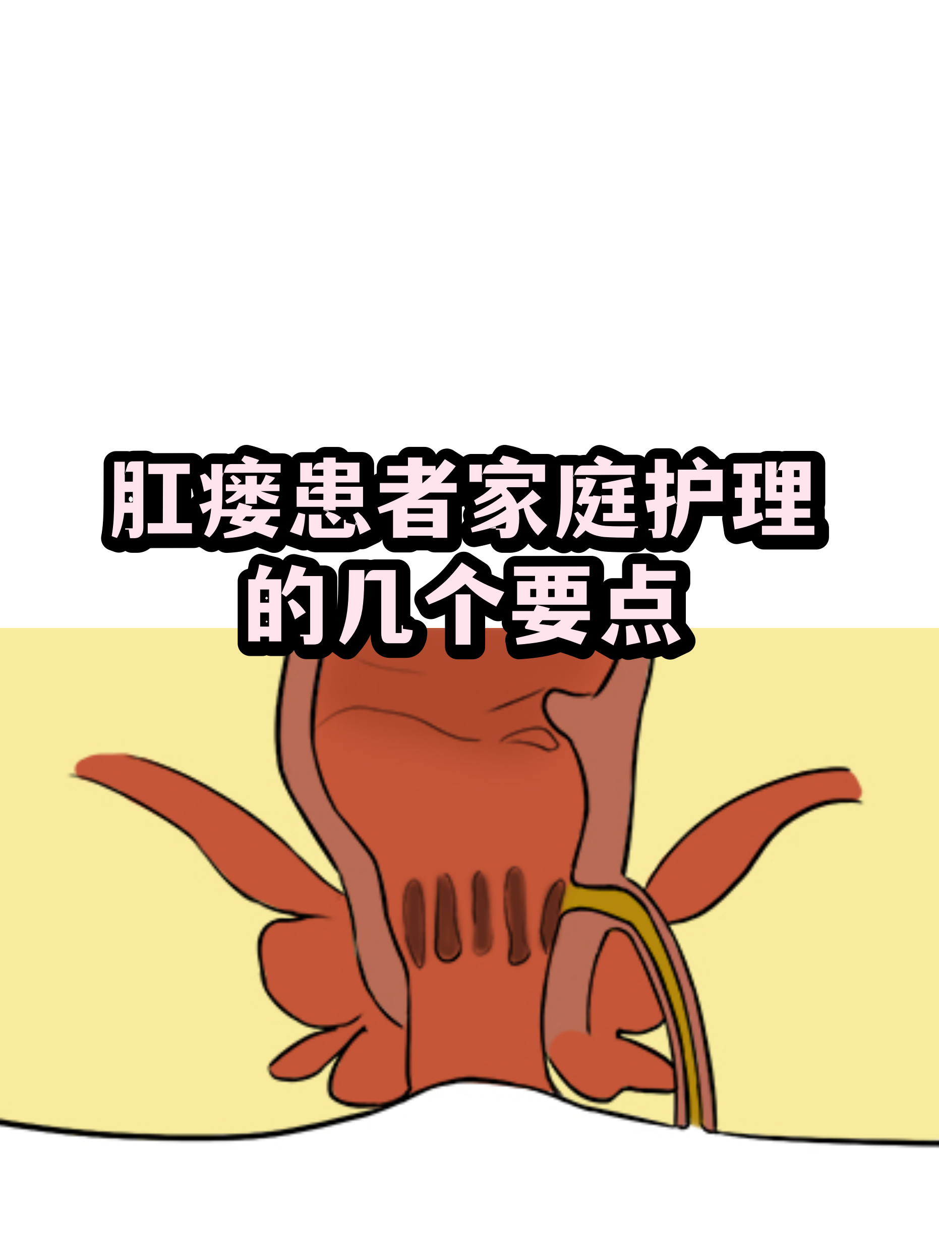 朝阳医院医院排队代办挂号出院居家护理提醒，科学恢复身体的简单介绍