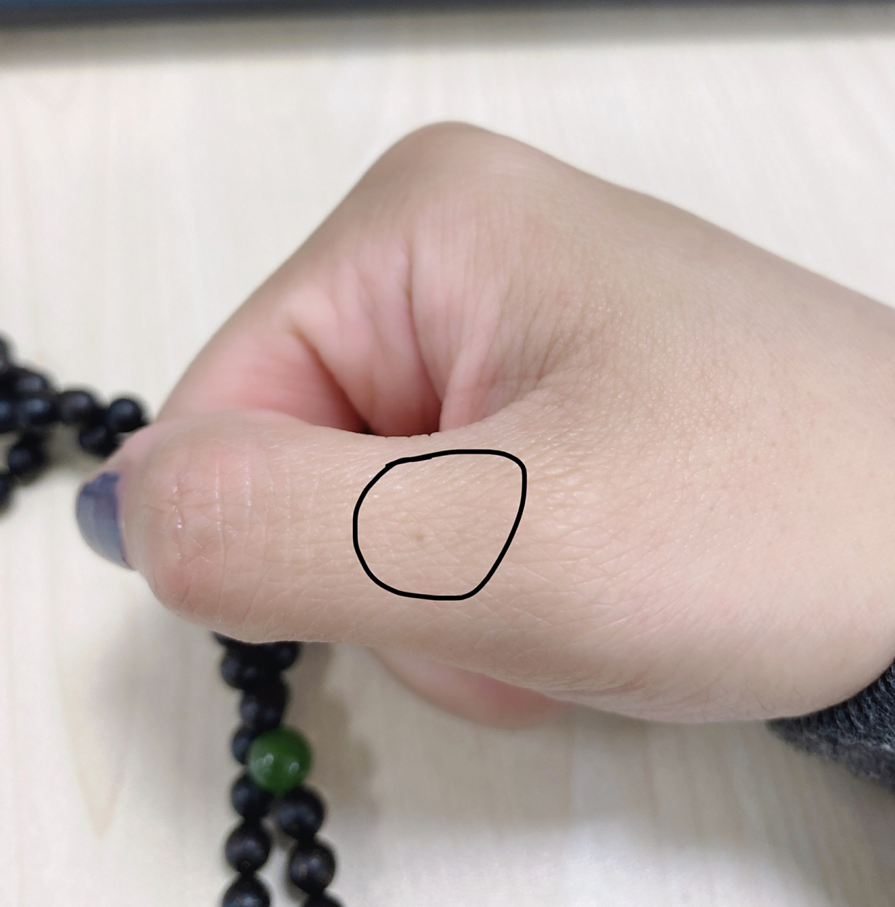 右手大拇指长痣是什么意思