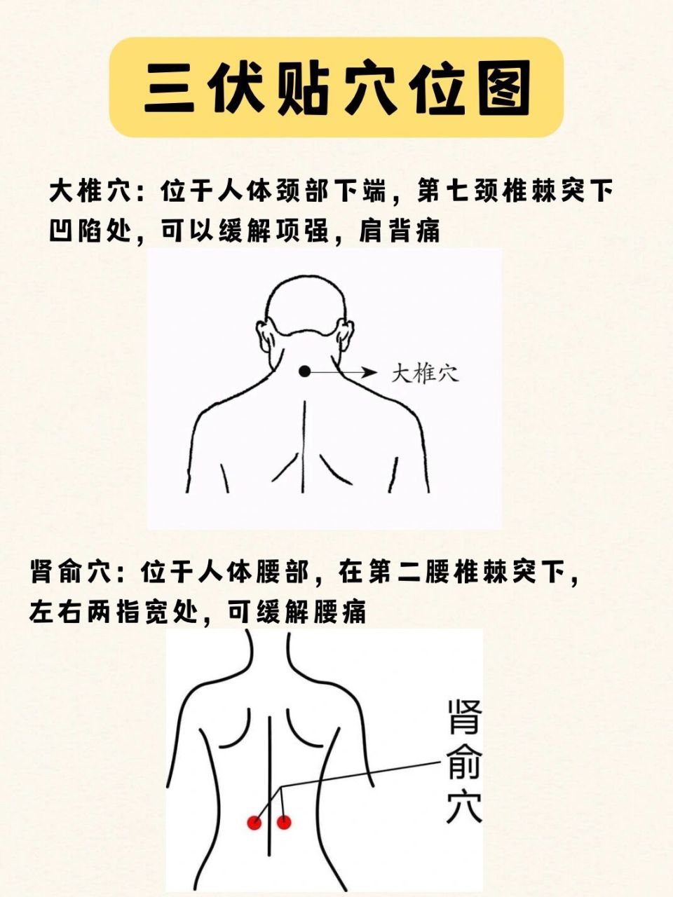 三伏贴穴位图|关节炎克星6015 因为我的妈妈有关节炎,学了中医后