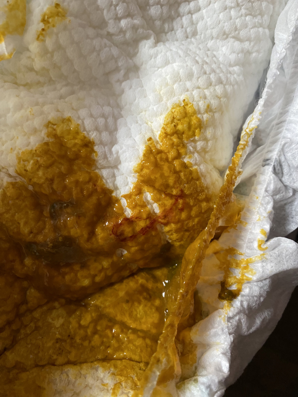 五月龄宝宝大便带血丝 养娃的过程太搞心态 宝宝满月以后较少服用益生