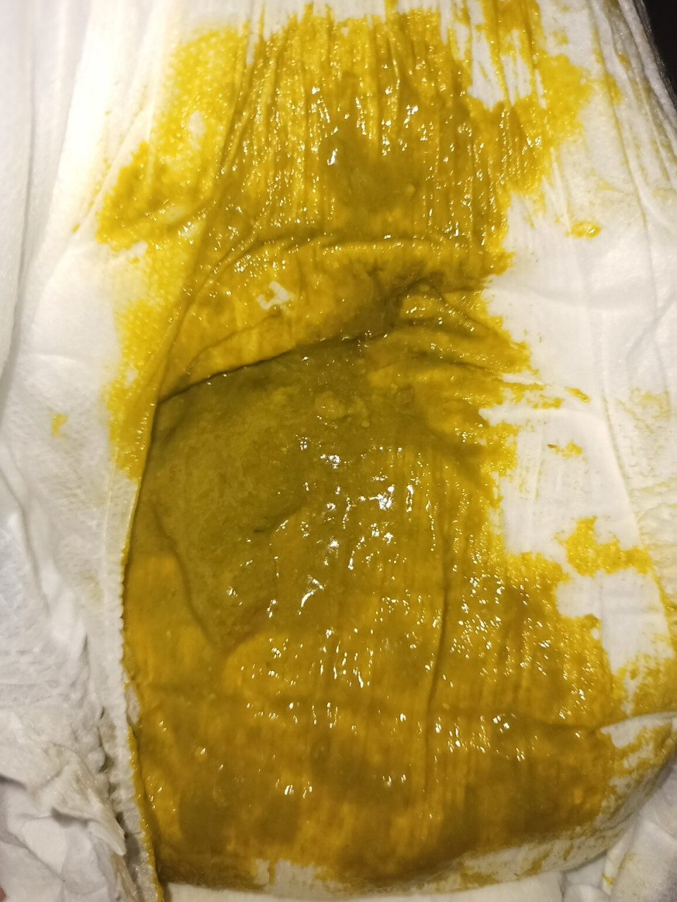 宝宝粘液便 宝宝还有10天就6个月了,本来已经是一天一两次的带糊状的