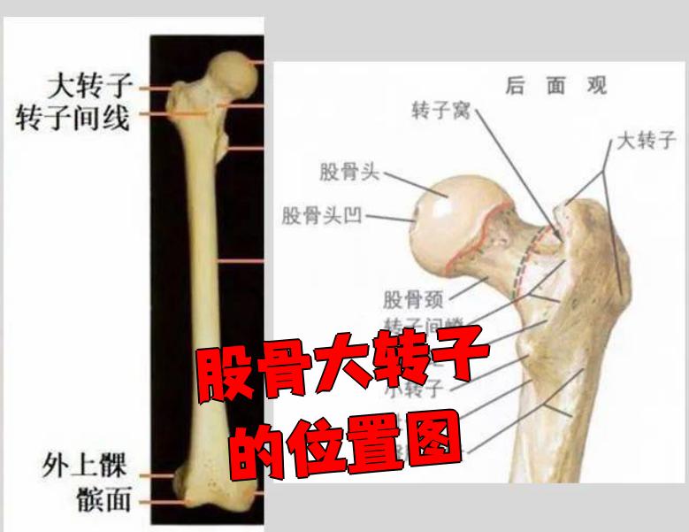 股骨大转子是股骨颈和股骨体连接处上外侧的一个