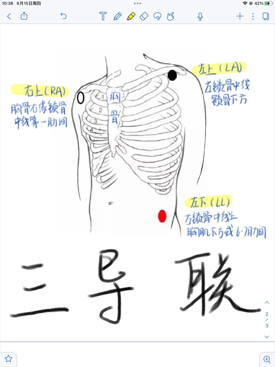 一分钟学会心电图导联位置✅ 哈喽大家好!