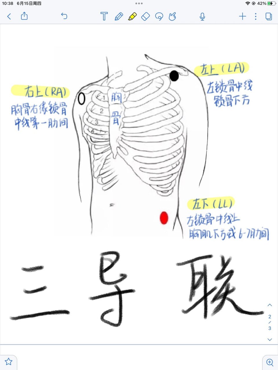 心电图导联的位置颜色图片