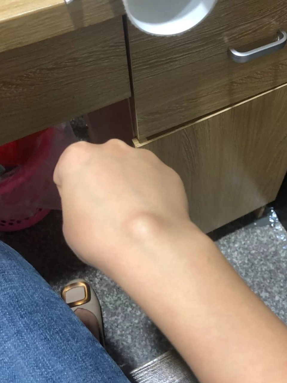 腱鞘炎妈妈手 腱鞘炎妈妈手,手腕鼓包还有救吗  一个人带娃,大宝从