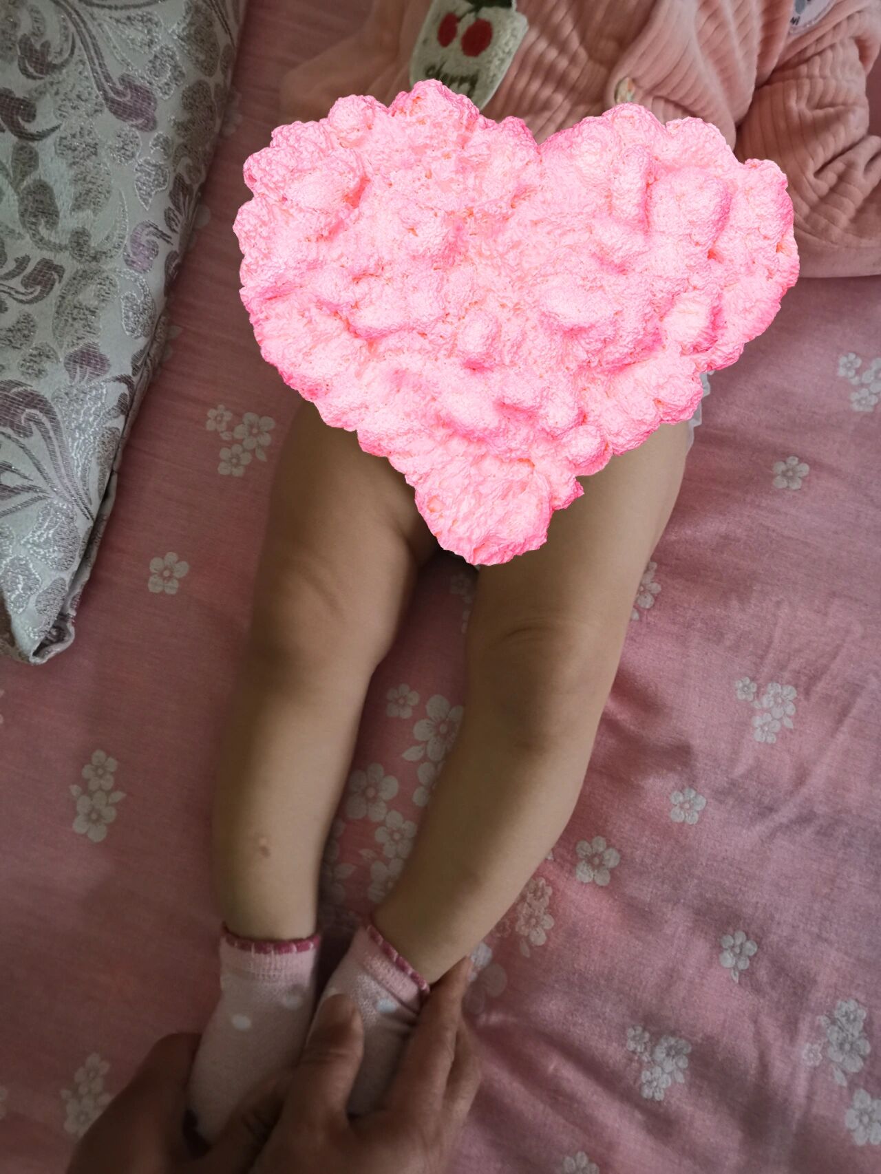 宝宝佝偻病导致的o型腿 在首都儿研所看了骨科和内分泌科,这些天我