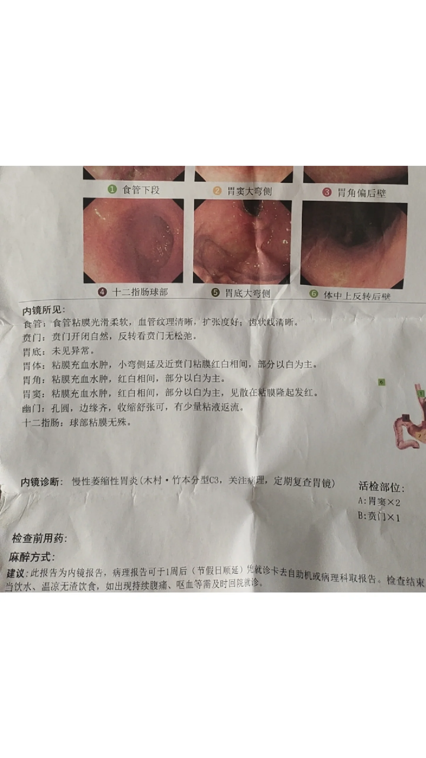 希望他改一下习惯