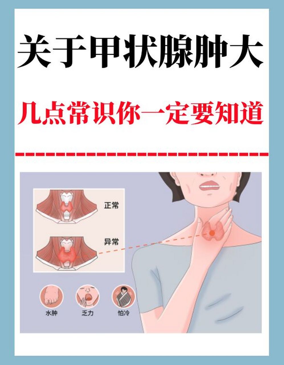 关于甲状腺肿大,这几点常识你一定要知道 甲状腺肿大指的是人体甲状腺