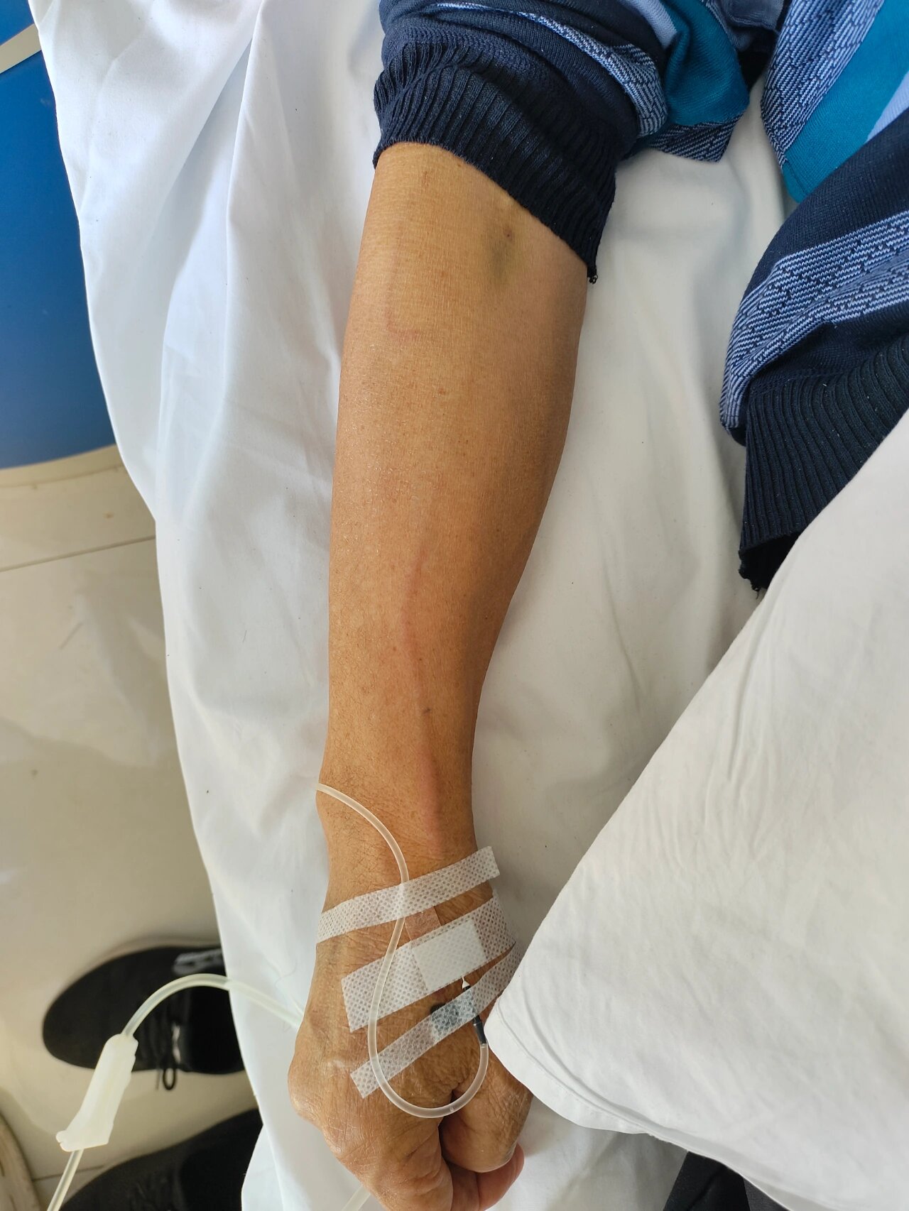 照着课本上,标准静脉炎