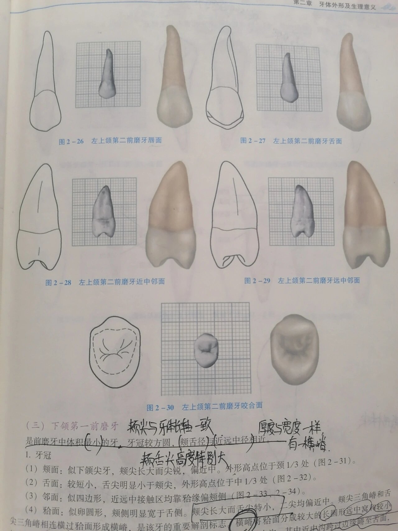 下颌第三磨牙解剖图图片