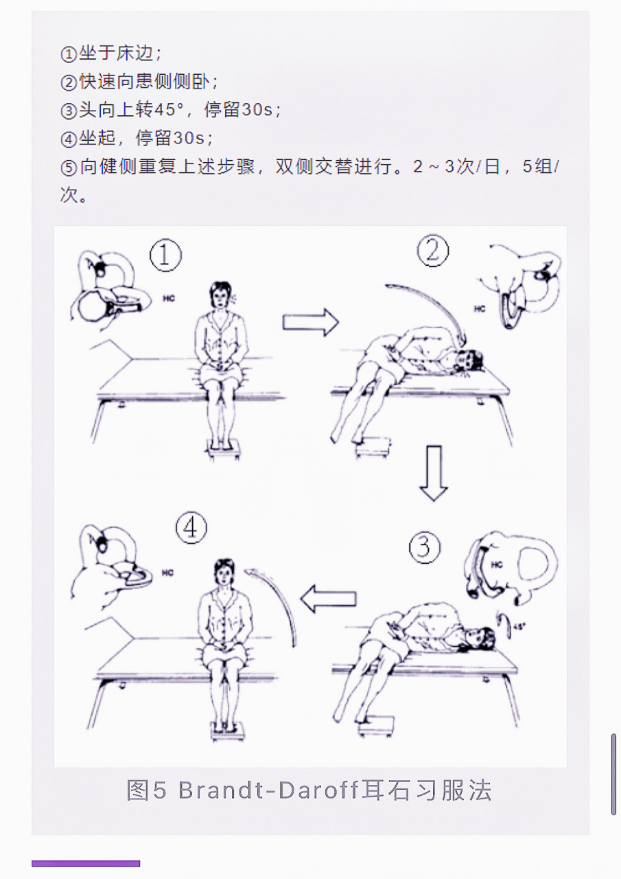 耳石症简单手法复位图图片