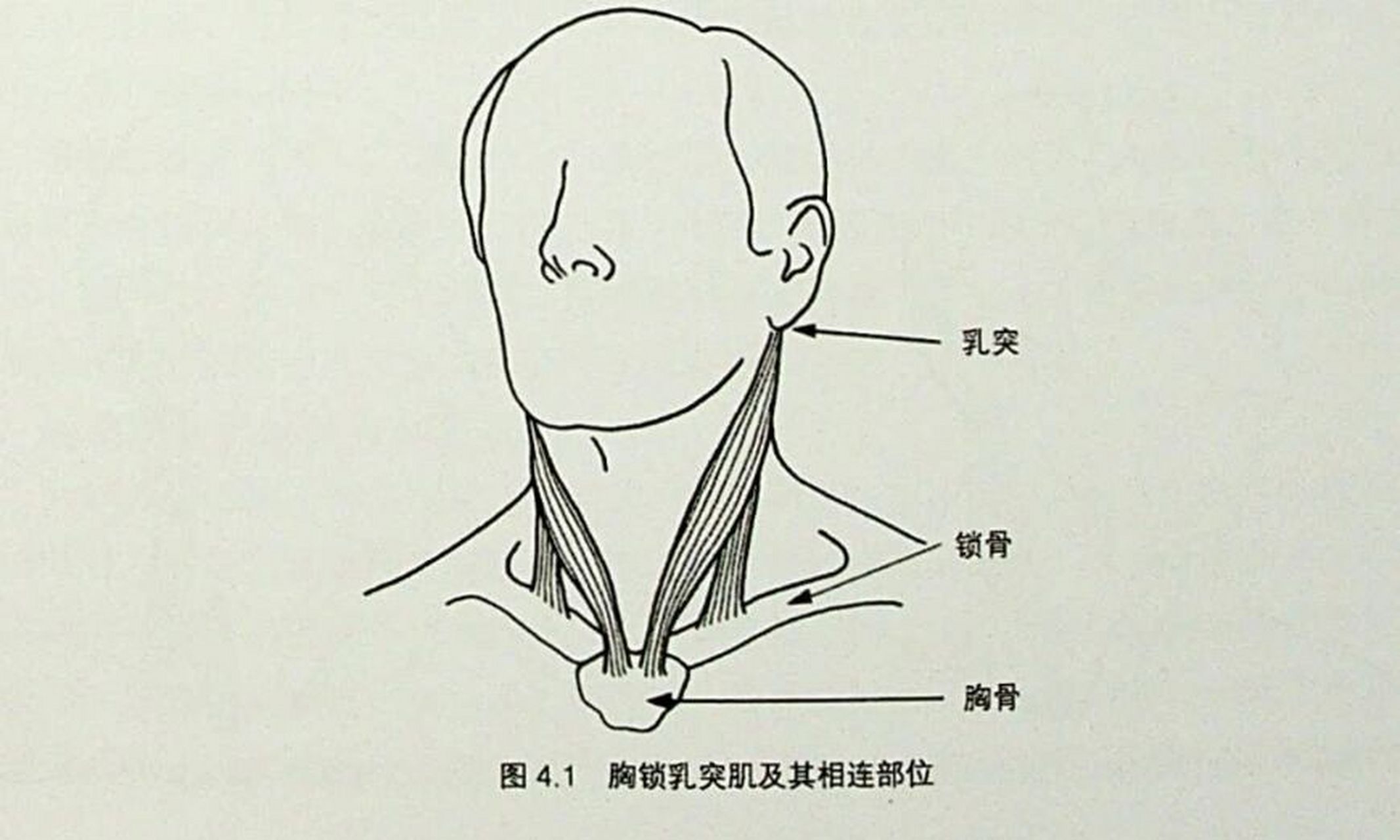 颈部最重要的三块肌肉——胸锁乳突肌 胸锁乳突肌这个名称来源于这块